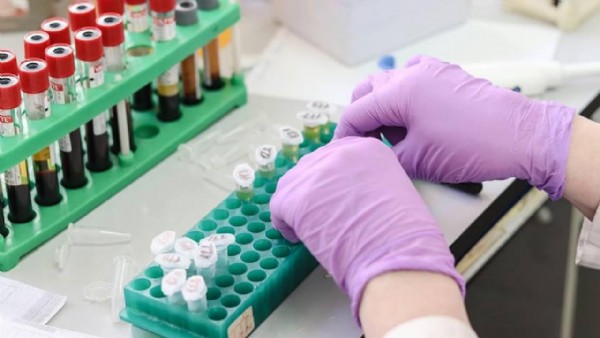 SMA Tarama Testi Nasıl Yapılır? Evlilik Öncesi SMA Taraması Nerede Yaptırılır?